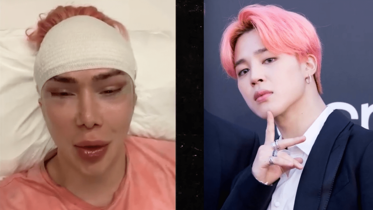 Cantante recibe amenazas tras cirugía para lucir como Jimin de BTS