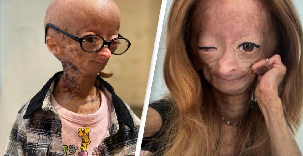 Fallece Adalia Rose Williams, youtuber que inspiró la película de Benjamin Button