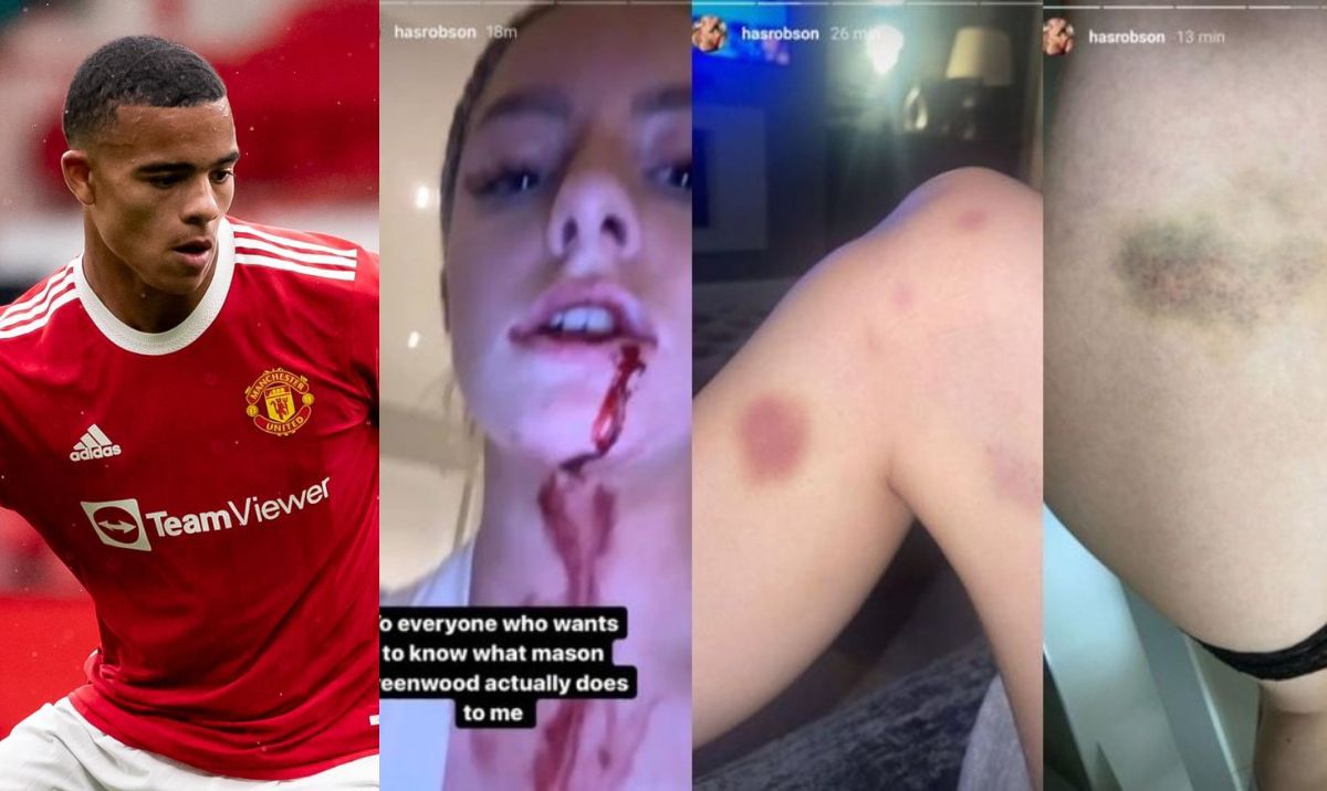 Investigan a jugador del Manchester United por agredir a su pareja