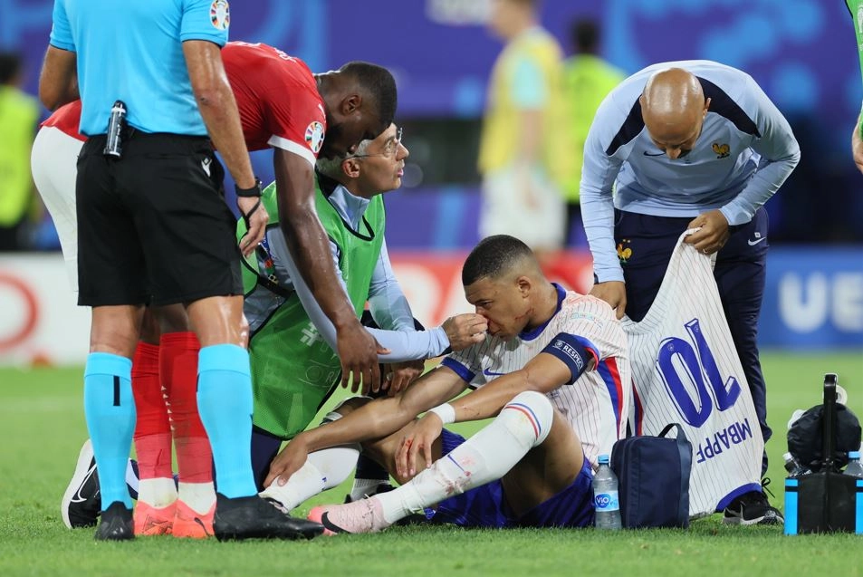 EURO 2O24: Malas noticias para Kylian Mbappé