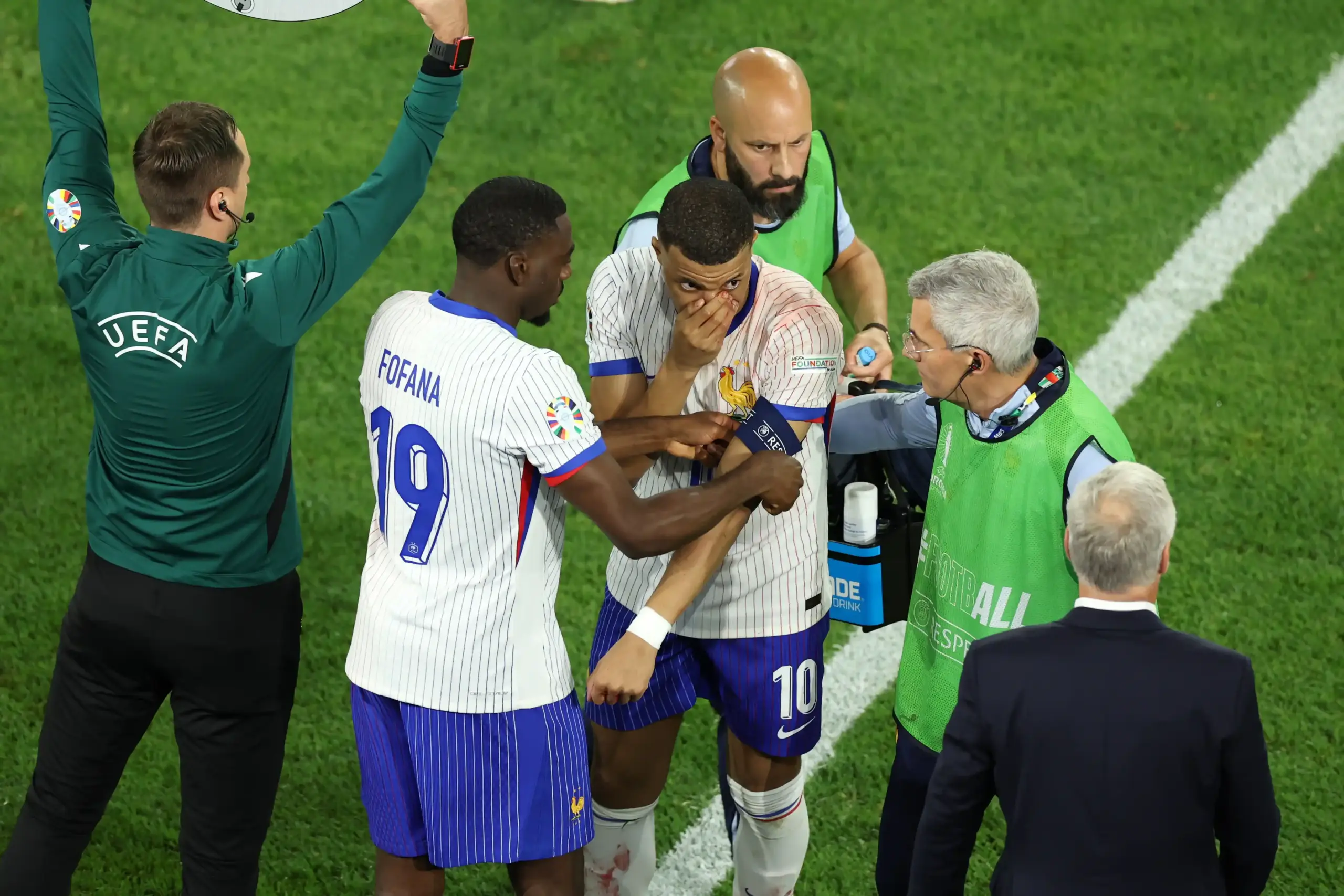 Mbappé no termina el partido de Francia tras fuerte golpe